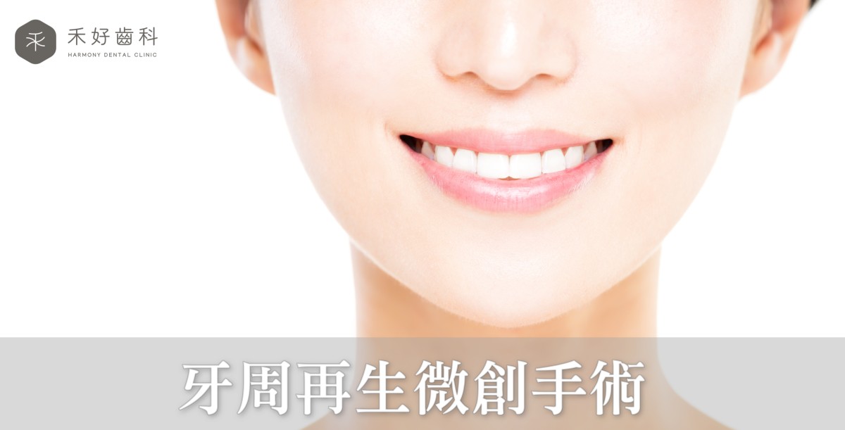牙周再生微創手術 牙周再生微創手術