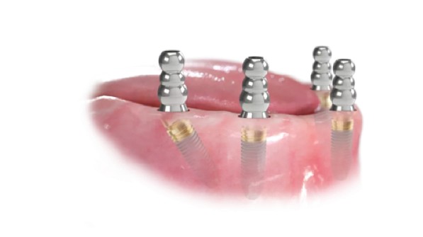 https://new.harmonydc.com.tw/wp-content/uploads/2025/07/teeth-02.jpg