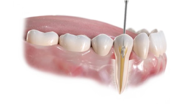 https://new.harmonydc.com.tw/wp-content/uploads/2025/07/teeth-03.jpg