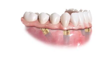 https://new.harmonydc.com.tw/wp-content/uploads/2025/07/teeth-04.jpg