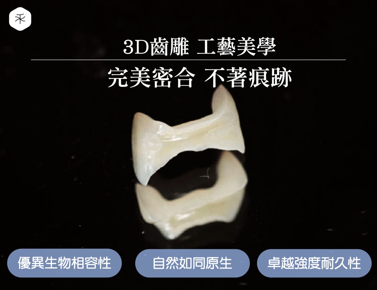 3D齒雕